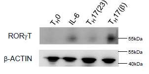 We next examined impact of JunB deficiency on IL-23-stimulated T H 17( ) cells in the absence of TGF-.