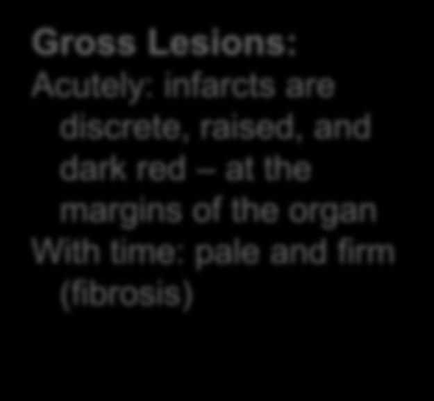 Septic emboli } Due to thrombosis Gross Lesions: Acutely: infarcts are discrete,