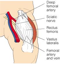 Vastus lateralis (Outer/Lateral thigh) is