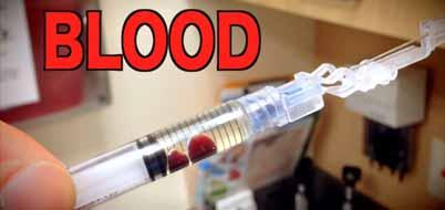Discard Syringe if Needed If blood is present when aspirating, withdraw the needle and