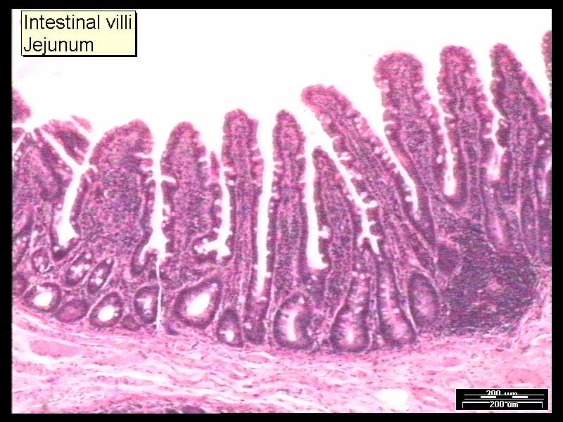 Jejunum (Small Intestine) Each villi itself has tiny fingerlike