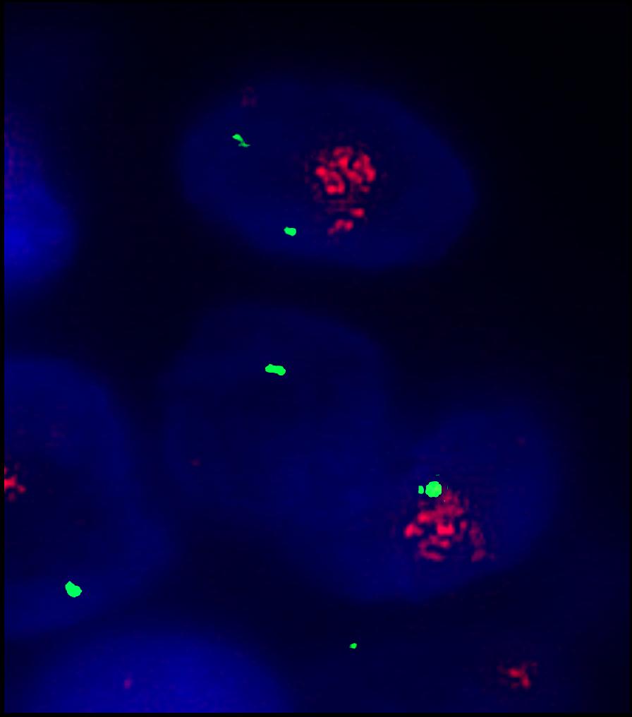 hybridized with target Fluorescence in Situ Hybridization