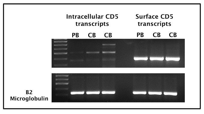 Figure 25. RT-PCR of CD5 transcripts shows they are present in PB and CB.