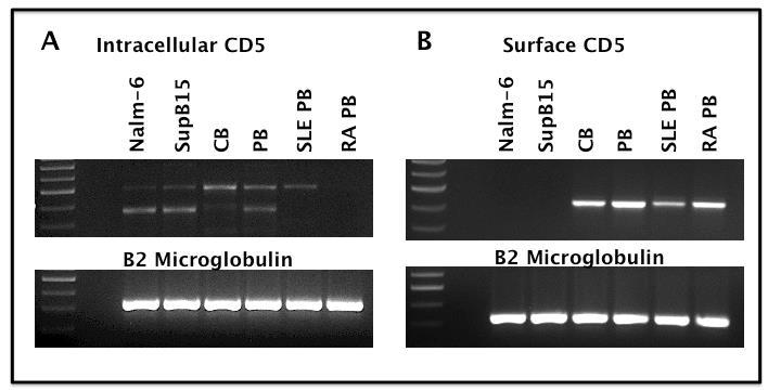 Figure 26. CD5 E1B transcripts were observed in pre-b cell lines and RA PB.