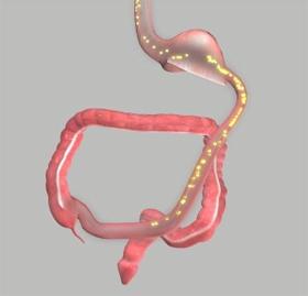 By bypassing the first two segments of the small intestine, the duodenum and jejunum, the small intestine is shortened therefore nutrient absorption is significantly reduced leading to weight loss.