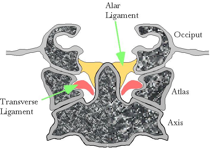 The alar ligament's attachments upon the posterior aspect of the dens are to a longitudinally ovoid depression to either side of the midline, about 1 to 5 millimeters lateral to the midline.