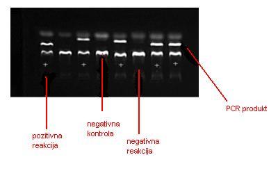 pozitivna (PCR produkt prisutan) ili negativna (PCR produkt odsutan). Pozitivna reakcija na gelu mora sadržavati internu kontrolnu vrpcu i vrpcu specifičnog PCR produkta.