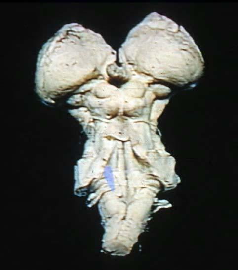 Dorsal View of the Brain Stem with Cerebellum removed.