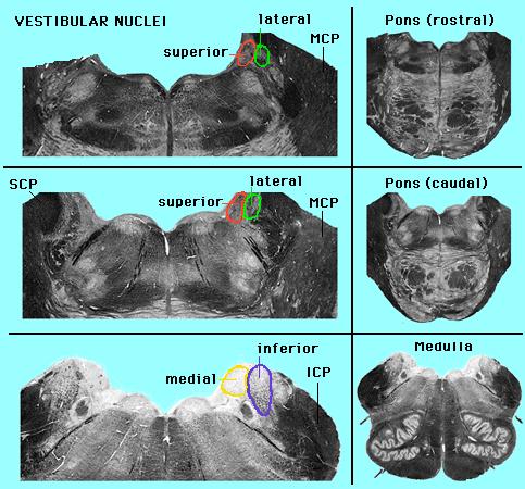 Note the nuclei are found underneath the IV ventricle in the rostral medulla and pons. You do not need to be able to recognize them.