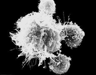 Dendritic cells bridge innate and adaptive immune
