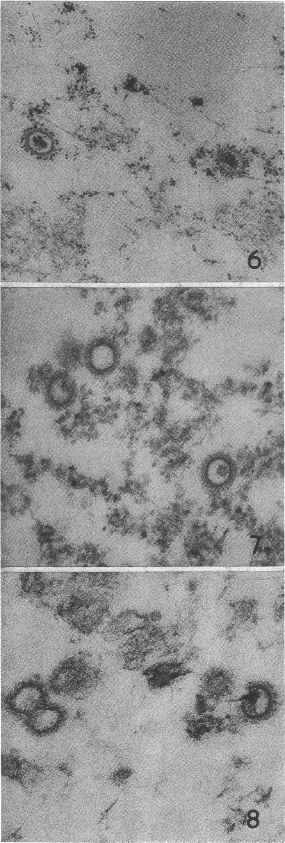 1410 Microbiology: Hampar et al Proc Nat Acad Sci USA 68 (1971) * nweaktagging of HTV particles when reacted twice with HR1K cells The three rabbit anti-htv conjugates showed ferritin tagging of HTV