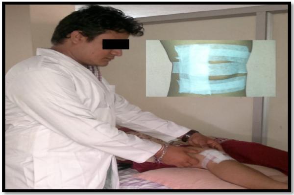 International Journal of Physical Education, Sorts and Health 2: The subjects were treated with ultrasound and isometric exercises.
