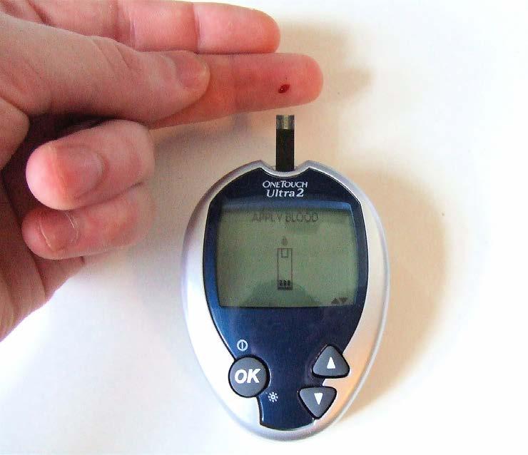 Improvement in Monitoring of Diabetes with Technology * Technology allowed paradigm change to