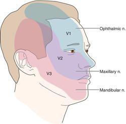 CN V: TRIGEMINAL (SENSORY) Distribution Ophthalmic Upper lids, forehead, cornea, top of nose