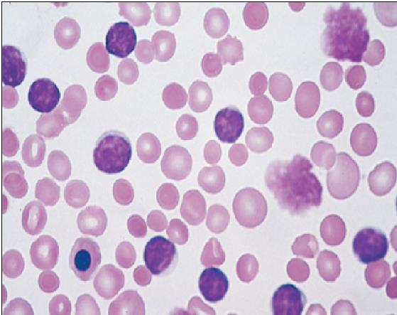 You look for antigens using immune stains, by applying antibodies. If the antigen is there you will get antigen-antibody reaction and the stain will appear. These are peripheral blood cells.