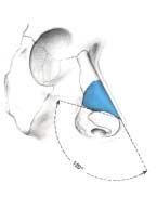 cartilage, septum and ß oor Figure 2: Internal valve