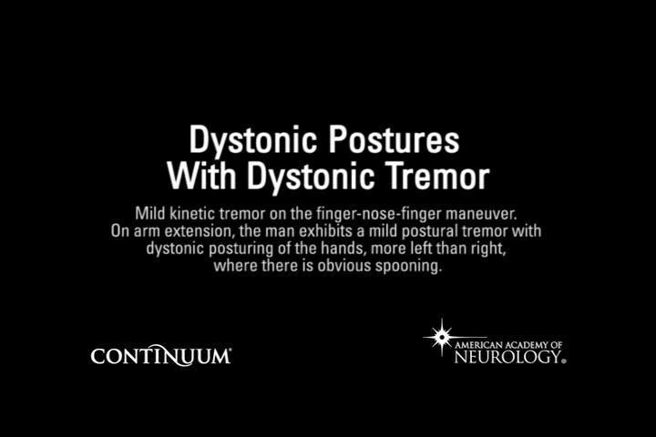 Dystonic
