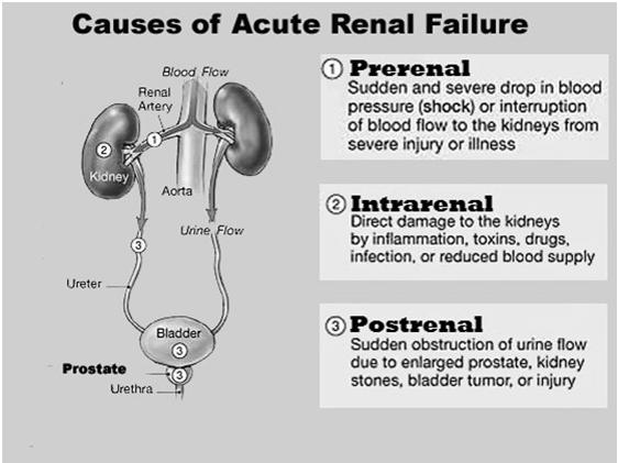 renal dysfunction Was this Prerenal, Renal, or