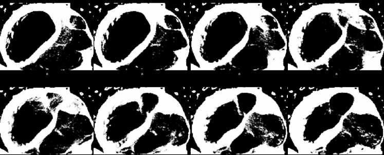 7 Figure 6: Myocardium 2.2.3 Lattice transformation In this approach, non-rigid image registration is done across the time frames in the CT datasets.