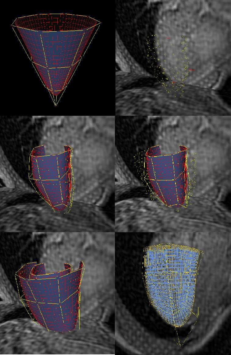 Figure 3: Left ventricle