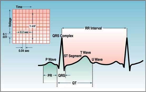 What is Long QT Syndrome (LQTS)? Long QT Syndrome (LQTS) is a heart rhythm disorder that can cause a disturbance in the electrical system of the heart.