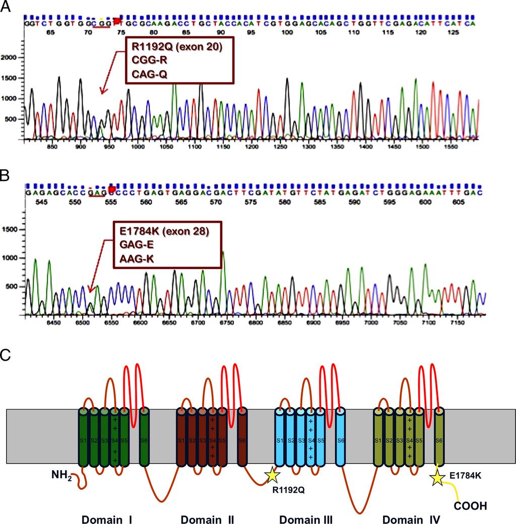 Hai et al Brugada and Long QT Syndrome 489 Figure 2 The sequence chromatogram of the 2 mutations: R1192Q (A) and E1784K (B) in SCN5A, the gene encoding Nav1.