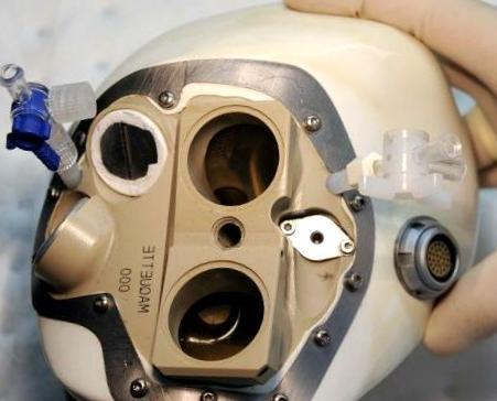 Total Artificial Heart Patients with different