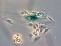 LN229-ctrl U8-NFKBIA+ LN229-NFKBIA+ % soft agar colony % soft agar