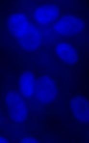U87 cells, and TMZ-treated U87 cells re-expressing NFKBIA (NFKBIA+), based on bioreduction of MTT dye