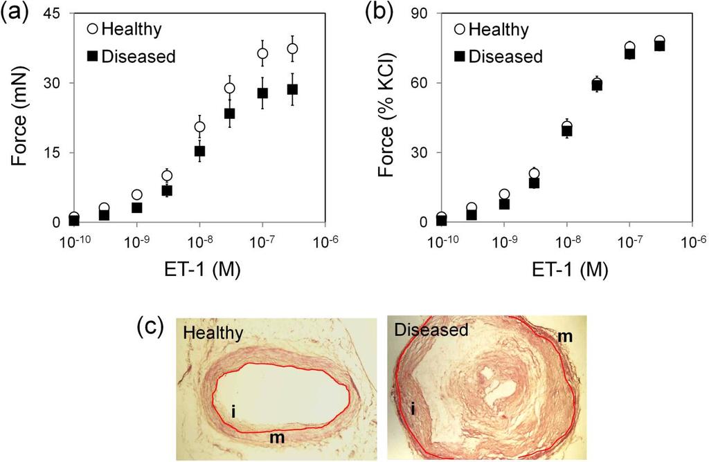 In vitro vasoconstrictor functional assays have been performed by Dr. Maguire on fresh human healthy and atherosclerotic arteries within 12 hours of retrieval (Ooi et al. 2014).