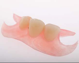 Our patients are strongly recommended to clean their dentures using this solution, because in such a way they will keep original aesthetic level of the denture, its color specificity and