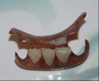 produce dentures from flexible thermoplastic materials that are increasingly