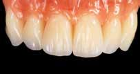 These teeth look as vibrant as their natural counterparts, and