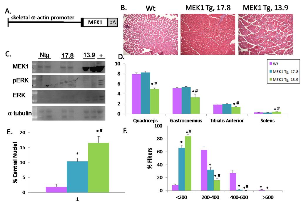 Figure 32. Skeletal muscle specific over-activation of ERK1/2 MAPK. A. Schematic of the transgene construct used to make the skeletal muscle specific constitutively active MEK1 Tg mice.