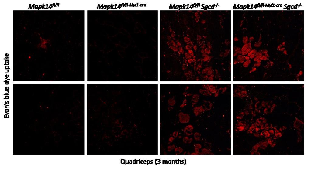 background also showed a dramatic reduction in serum CK levels at 3 months of age and far less inflammation macrophage and recruitment to the quadriceps and diaphragm compared with Sgcd -/- mice,