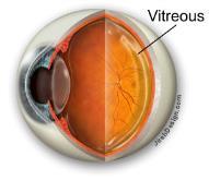 - A clear, viscous liquid that fills the inside of the posterior cavity of the eye - Keeps the retina in