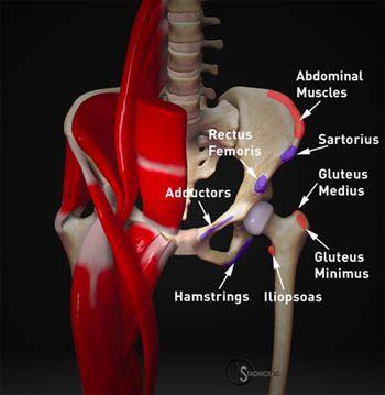 femoris or iliopsoas Avulsion of AS (sartorius) occurs