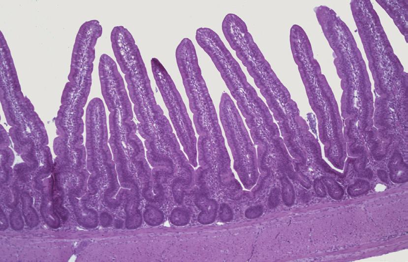Normal Intestinal Tract Normal Intestinal Tract Long finger-like projections are the villi