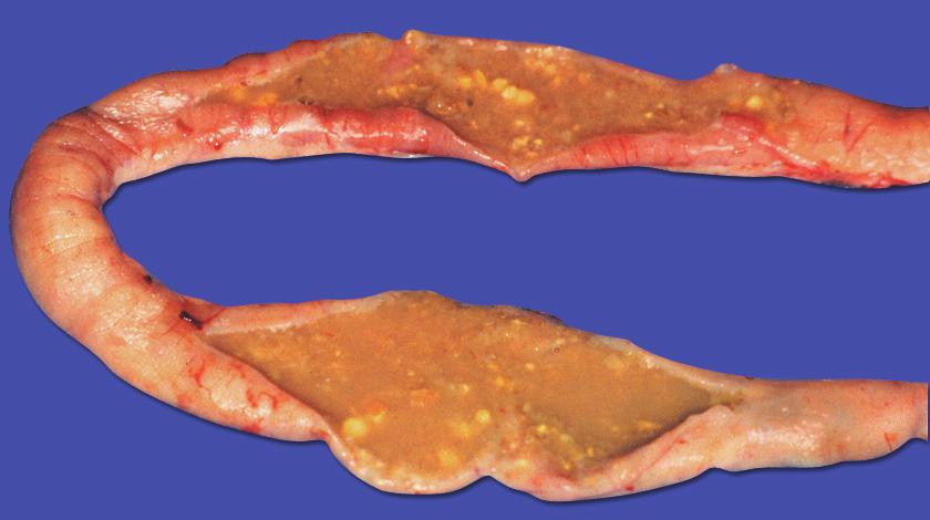 Intestinal wall is reddened and there are several pale yellow areas of necrosis.