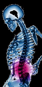 Musculoskeletal Disorders (MSDs) Affect the