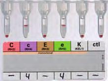 Rh Phenotyping IMMUNOHEMATOLOGY 11 Rh-Subgroups + C w + K This ID-Card offers a complete profile of the Rh phenotype and includes C w and K typing in one easy procedure.