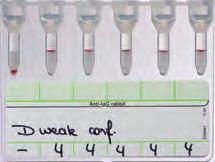 ID-DiaClon Anti-D for confirmation of D weak by IAT containing monoclonal IgG anti-d supplied as a ready-to-use reagent in vials of 5 ml. ID-DiaClon Anti-D 007531 (ld-n : 09410) ESD1 100 tests.
