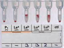 16 IMMUNOHEMATOLOGY Antigen Profiles ABO and RhD compatible blood is used for transfusion. In certain cases, Rh phenotypes and the status of the Kell-System are also taken into account.