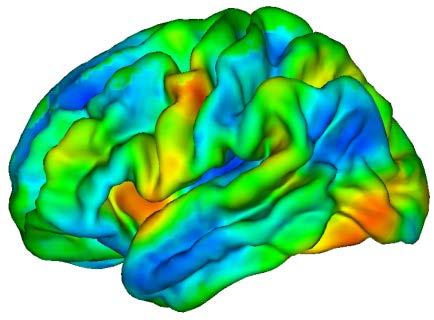 Updated Perspectives on the Neural Bases of Stuttering: Sensory & Motor Mechanisms Underlying Dysfluent Speech Reduced dynamic range to tune
