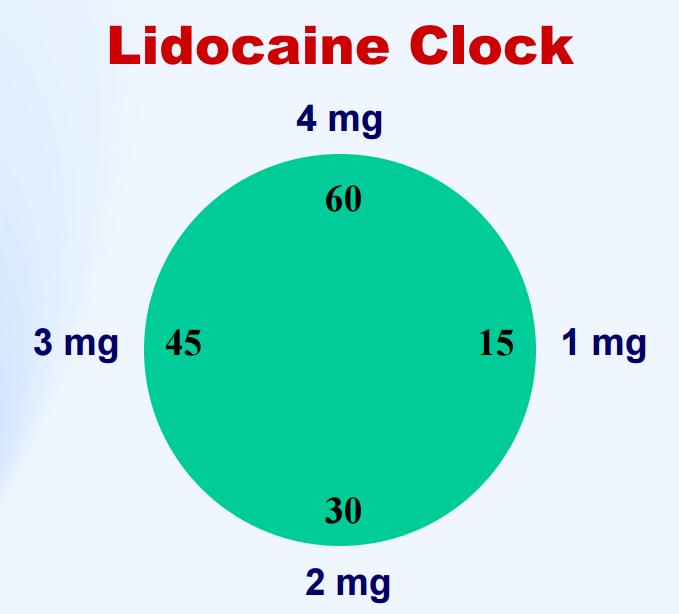 Lidocaine (40mg/2mL) Max concentration : 20mg/mL Solution : NSS, D5W Dosing instruction : Bolus : 1-1.5 mg/kg over 2-3 mins (average 50-100mg) ; repeat dose 0.5-0.