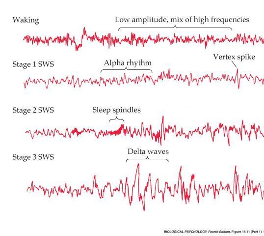 Brain activity during sleep Awake Low amplitude high