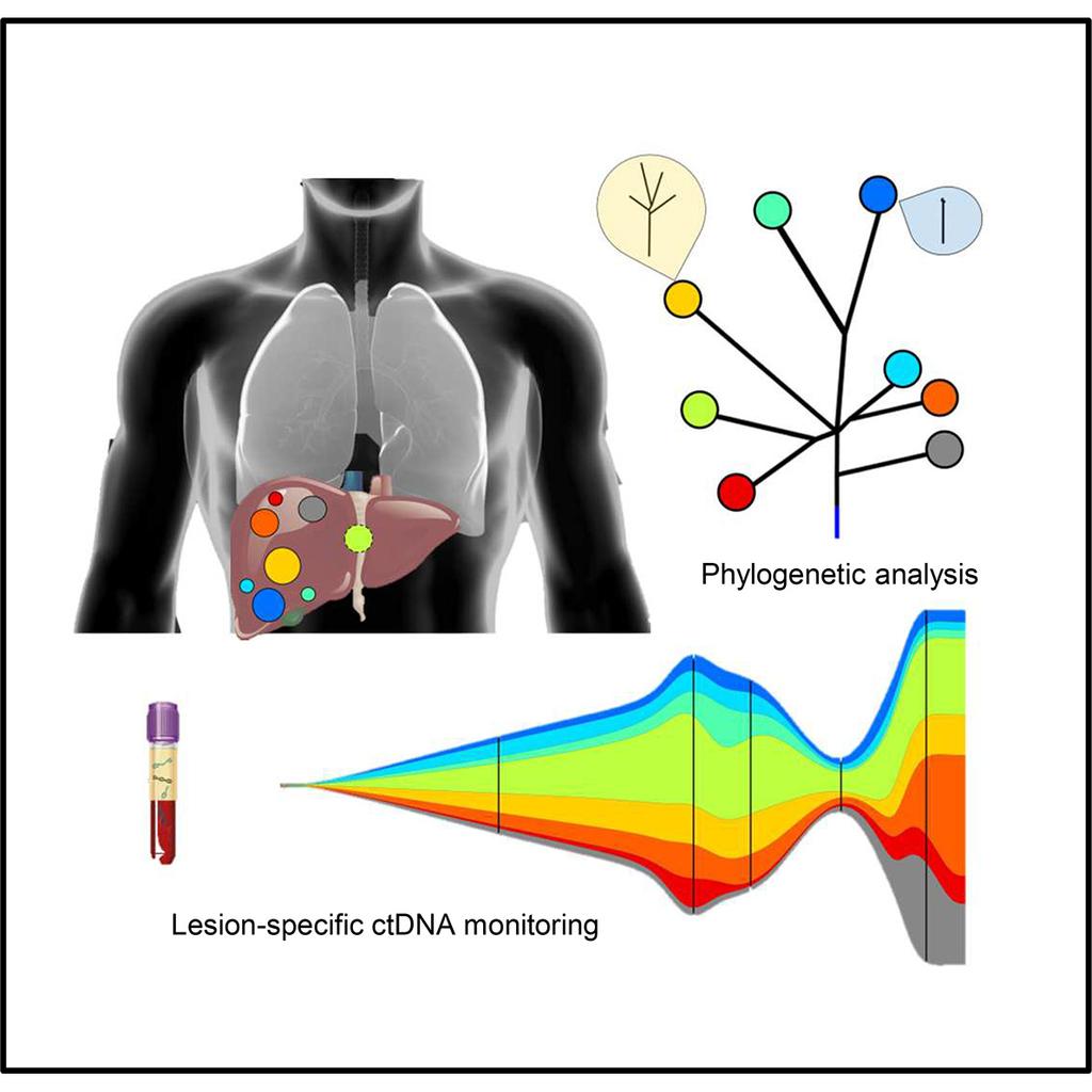 Article Radiologic and Genomic Evolution of Individual Metastases during HER2 Blockade in Colorectal Cancer Graphical Abstract Authors Giulia Siravegna, Luca Lazzari, Giovanni Crisafulli,.