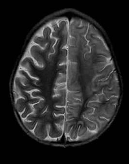 Photo 3: Diffusion-weighted MRI