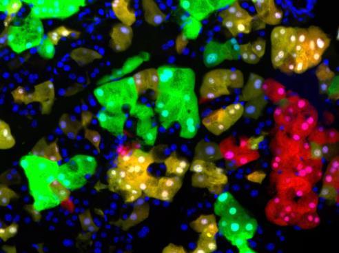 c) Pancreatic islet harboring green, red, and yellow cells.