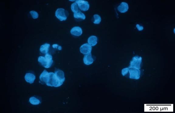DNA samples in the untreated cells